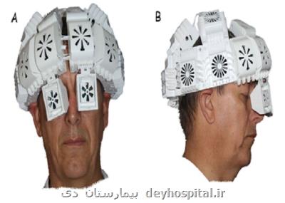 نور مادون قرمز رویکرد جدیدی برای درمان زوال عقل