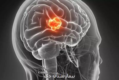 داروهای HIV برای درمان تومورهای مغزی موثرند
