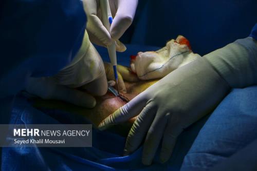 انجام ۱۴ پیوند کلیه و کبد در نخستین روز سال نو