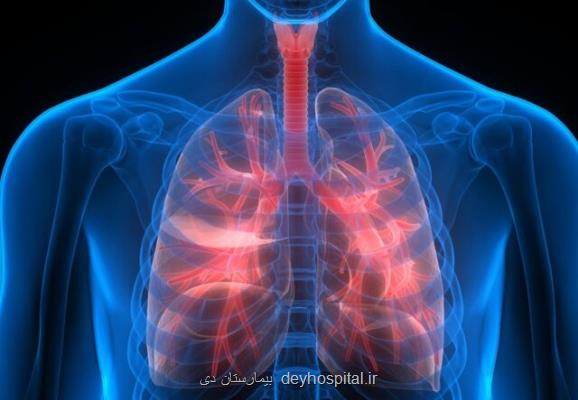 تغییرات اقلیمی و مشکلات تنفسی