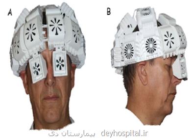 تشخیص زودهنگام آلزایمر از ۱۷ سال قبل