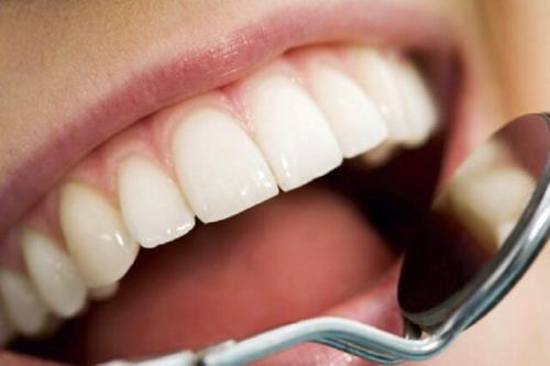 اثرات مخرب نوشابه و قهوه بر سلامت دندان ها
