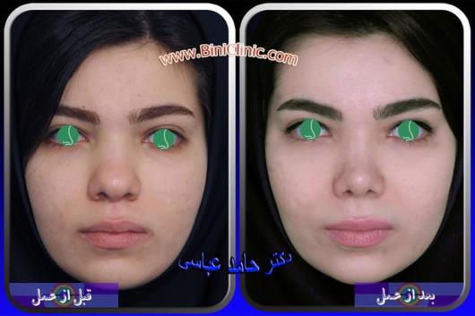 انتخاب جراح متبحر و تکنیک های جراحی آن