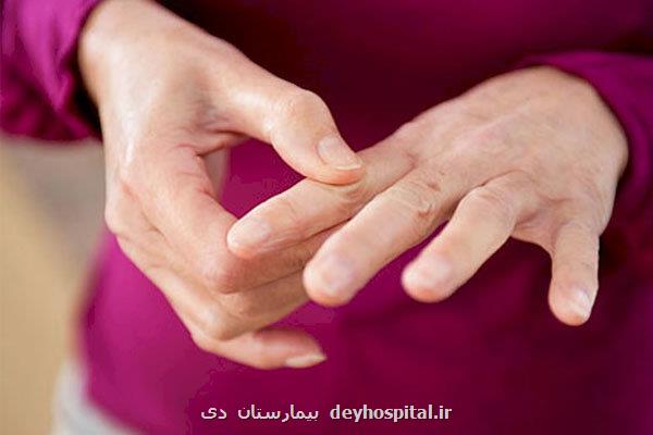 تاثیر داروی درمان آرتریت روماتوئید در پیش گیری از بیماری