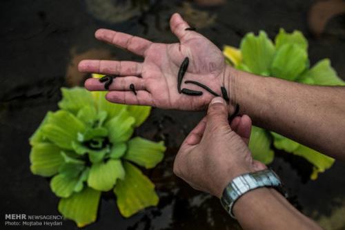 چه کسانی نباید سراغ زالودرمانی بروند