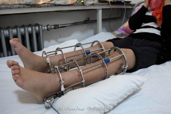جراحی افزایش قد معجزه یا شکنجه مدرن؟