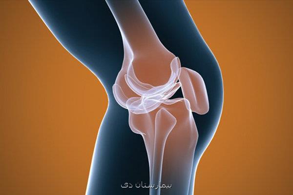 داروی رایج دیابت، مؤثر در تسکین درد آرتروز زانو