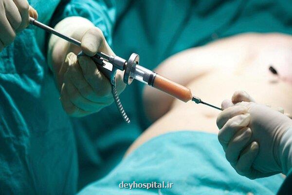 بوتاکس برای کاهش وزن؟ جراح عمومی پاسخ داد