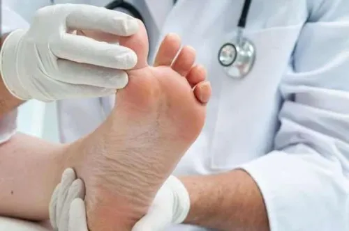 آن چه باید درباره ی درد پاشنه بدانیم