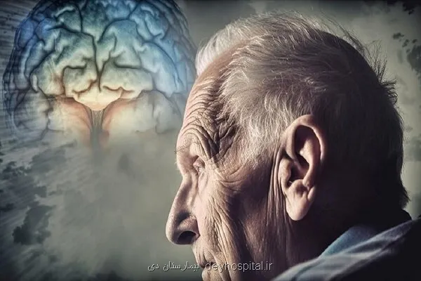 ارتباط سکته خفیف با افزایش ۳۴ درصدی زوال عقل در بلند مدت