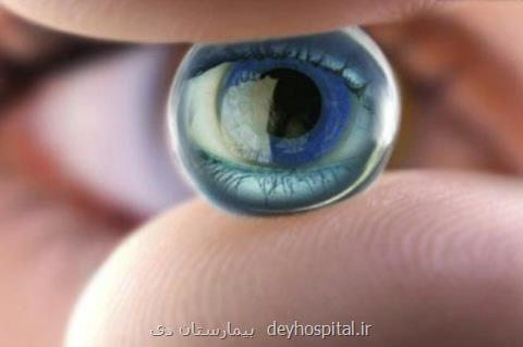 صدمه چشم با استفاده از لنزهای متفرقه، خدمات اپتومتری بیمه نیست