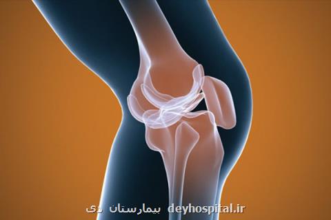 پیچ خوردگی مكرر مچ پا فرد را مستعد مبتلاشدن به آرتروز می كند
